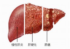 廣州送菜公司了解富川富陽鎮(zhèn)千畝蔬菜種植基地助農增收